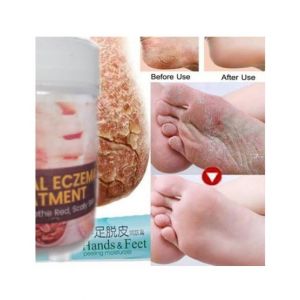 Marham Herbal Hand & Feet Moisturizer Balm Cream